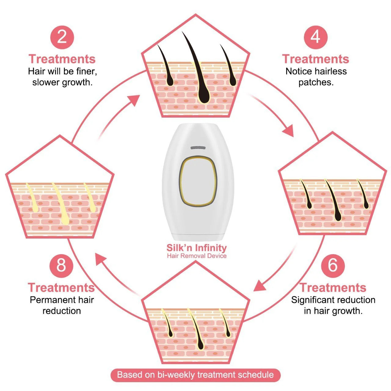 🌸Portable IPL Hair Removal laser – Face & Body
